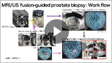 2. 前立腺癌に対するMRI/US fusion-guided biopsy「放射線科医の立場から」