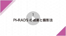 PI-RADS version 2.1に基づいた前立腺癌 MRI診断①